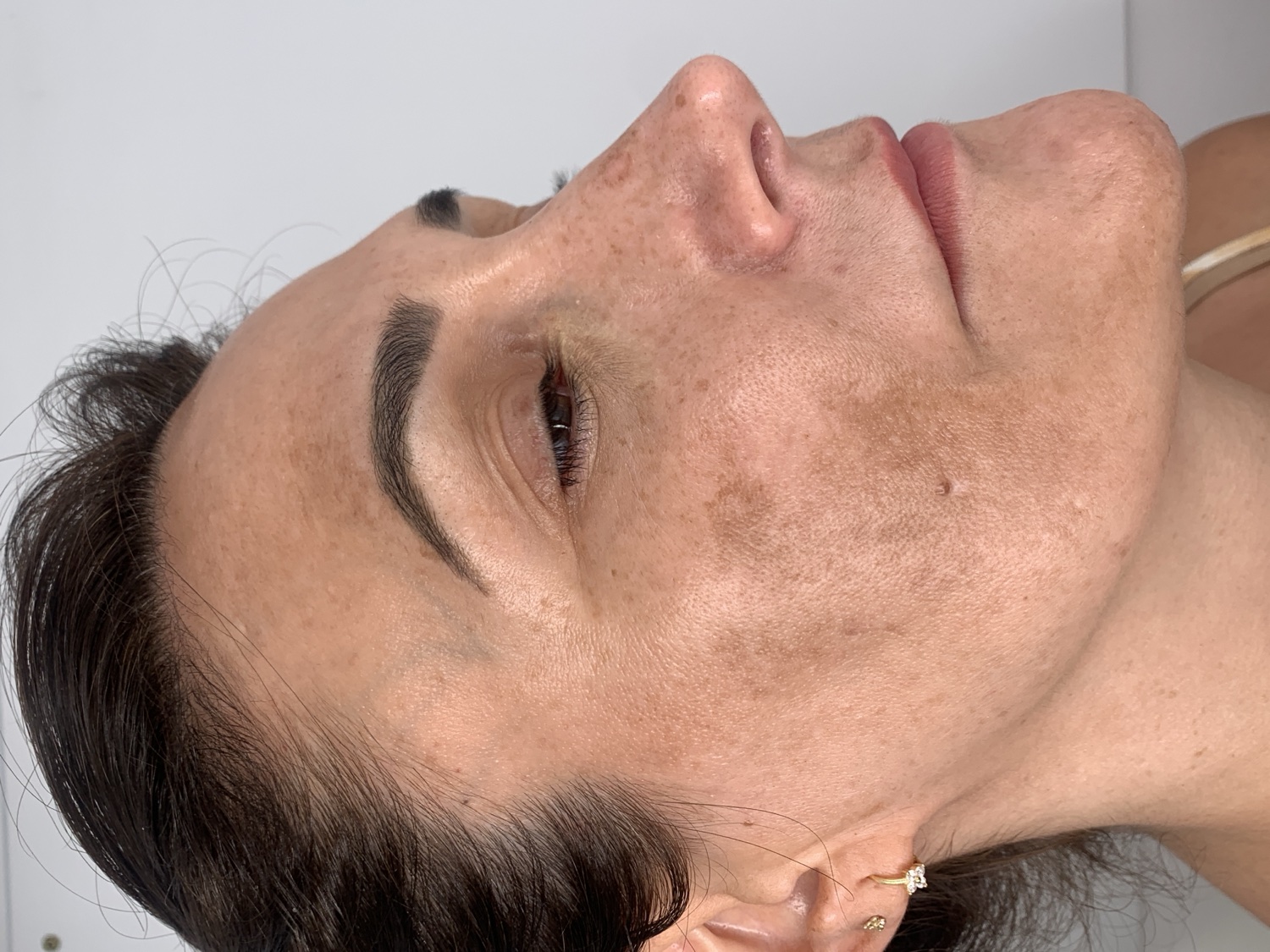 Aclaración de pigmentación · Impuls Longevity
