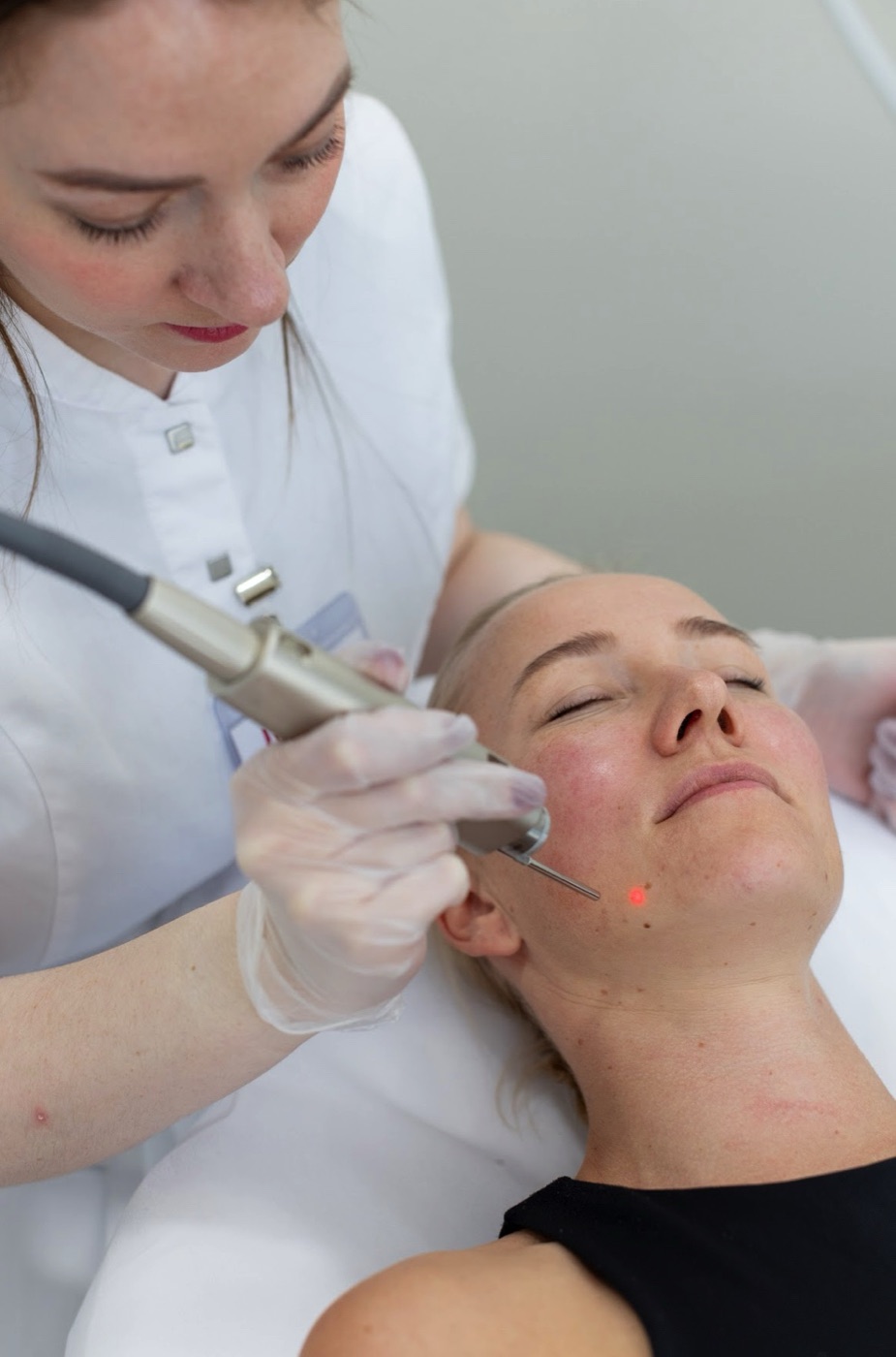 Tratamiento del acné · Impuls Longevity