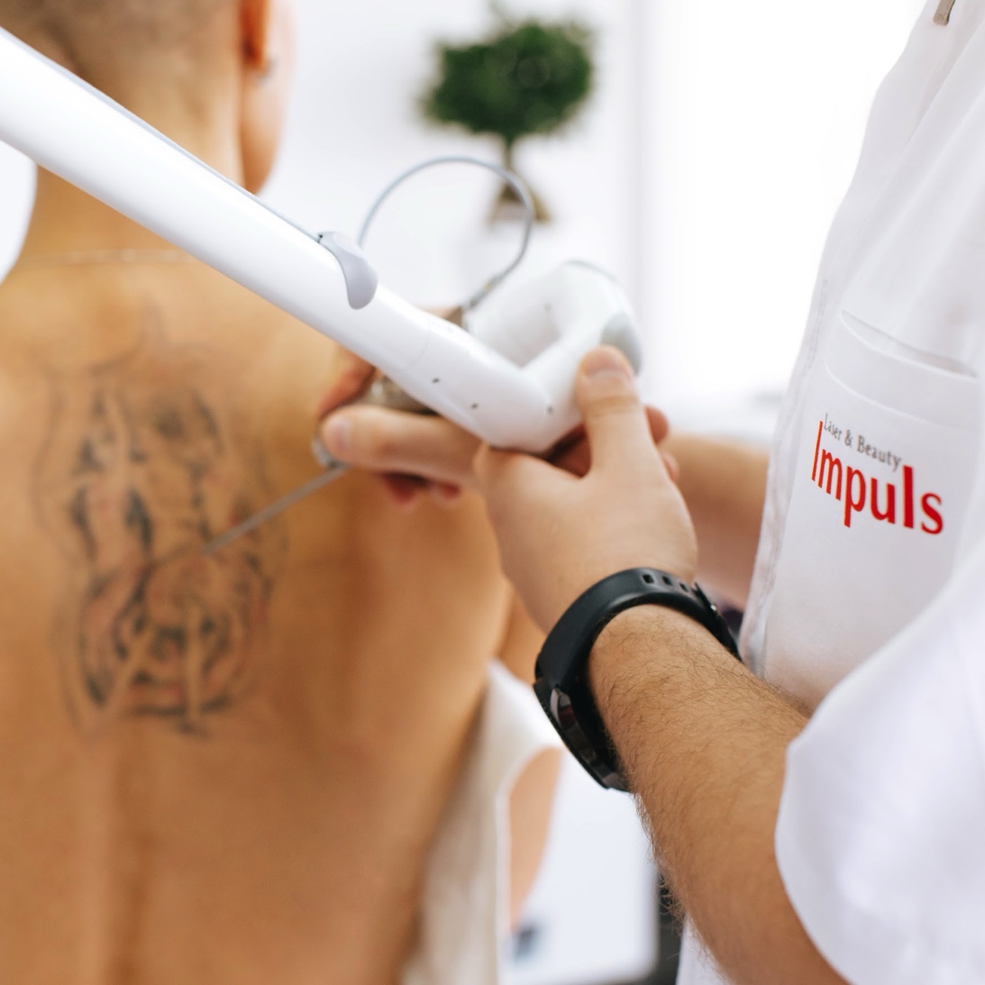 Aclaración de tatuajes · Impuls Longevity